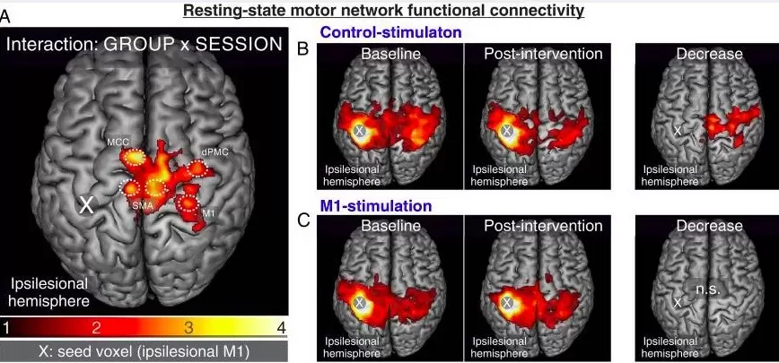 Motor function after stroke is promoted by early neural network reorganization 7 Image 12.01.2023 at 10.56 1
