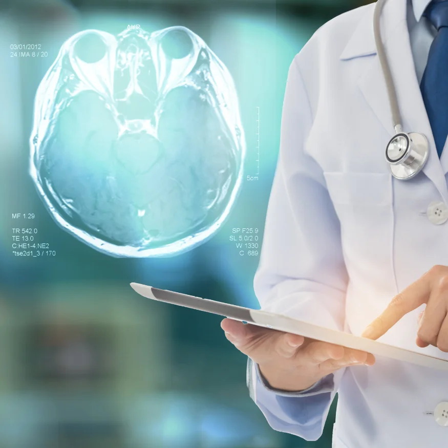 Neurorehabilitation therapies after stroke - what therapies are available? 1 neurorehabilitation therapies after stroke