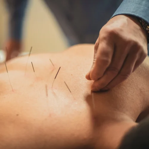 Intrinsic Mechanisms of Acupuncture in Ischemic Stroke Rehabilitation 1 Acupuncture in Ischemic Stroke Rehabilitation