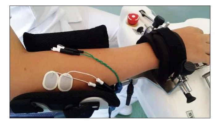 The effectiveness of surfaced-EMG controlled robot-assisted therapy in hand recovery after stroke 2 figure 1