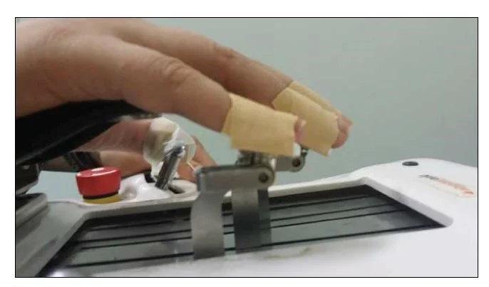 The effectiveness of surfaced-EMG controlled robot-assisted therapy in hand recovery after stroke 3 figure 2