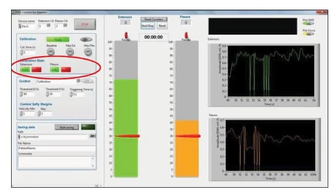The effectiveness of surfaced-EMG controlled robot-assisted therapy in hand recovery after stroke 4 figure 3