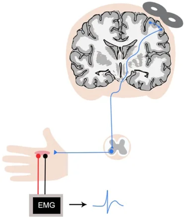 Does exercise induce neuroplasticity? 4 images 10.1177 1073858418771538 img2